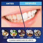 KIT BLANQUEADOR DENTAL 20 MINUTOS DENTAL WHITE RX