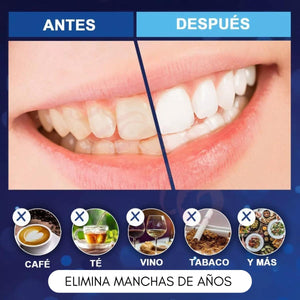 KIT BLANQUEADOR DENTAL 20 MINUTOS DENTAL WHITE RX